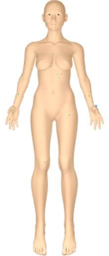 DermEngine Patient 3D Body Map New