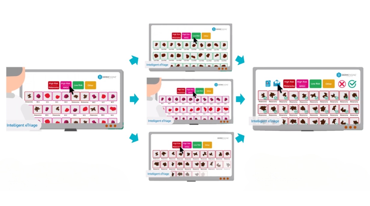 DermEngine-Intelligent-eTriage-Triage-system