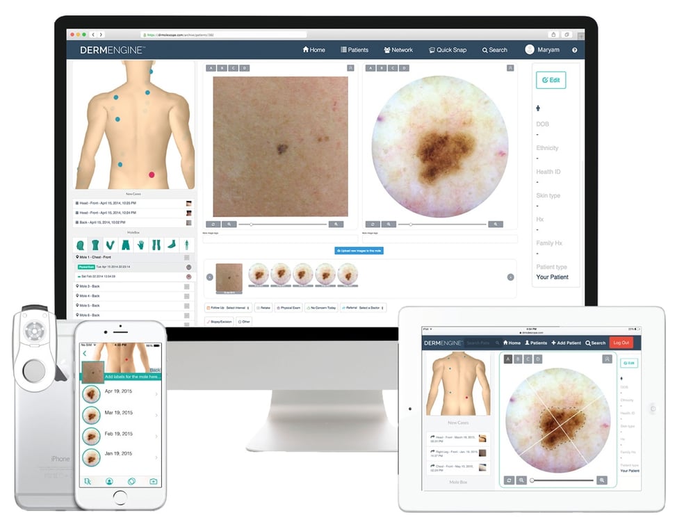 Dermengine Advanced Dermoscopy At Your Fingertips